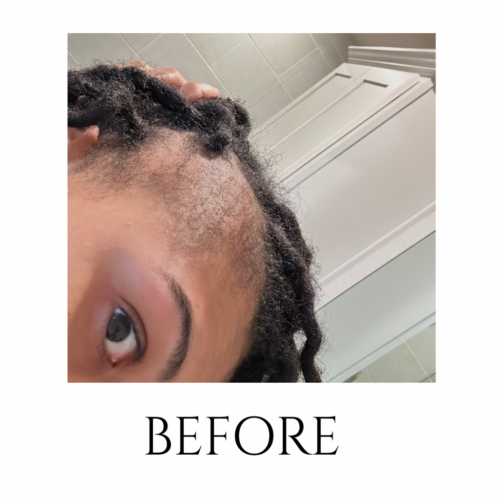 Herbal Hair & Scalp Oil