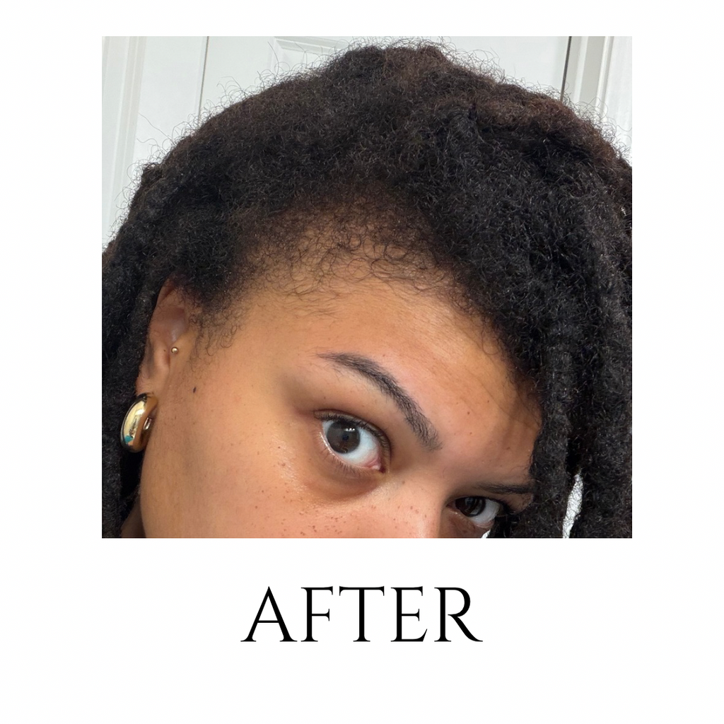 Herbal Hair & Scalp Oil