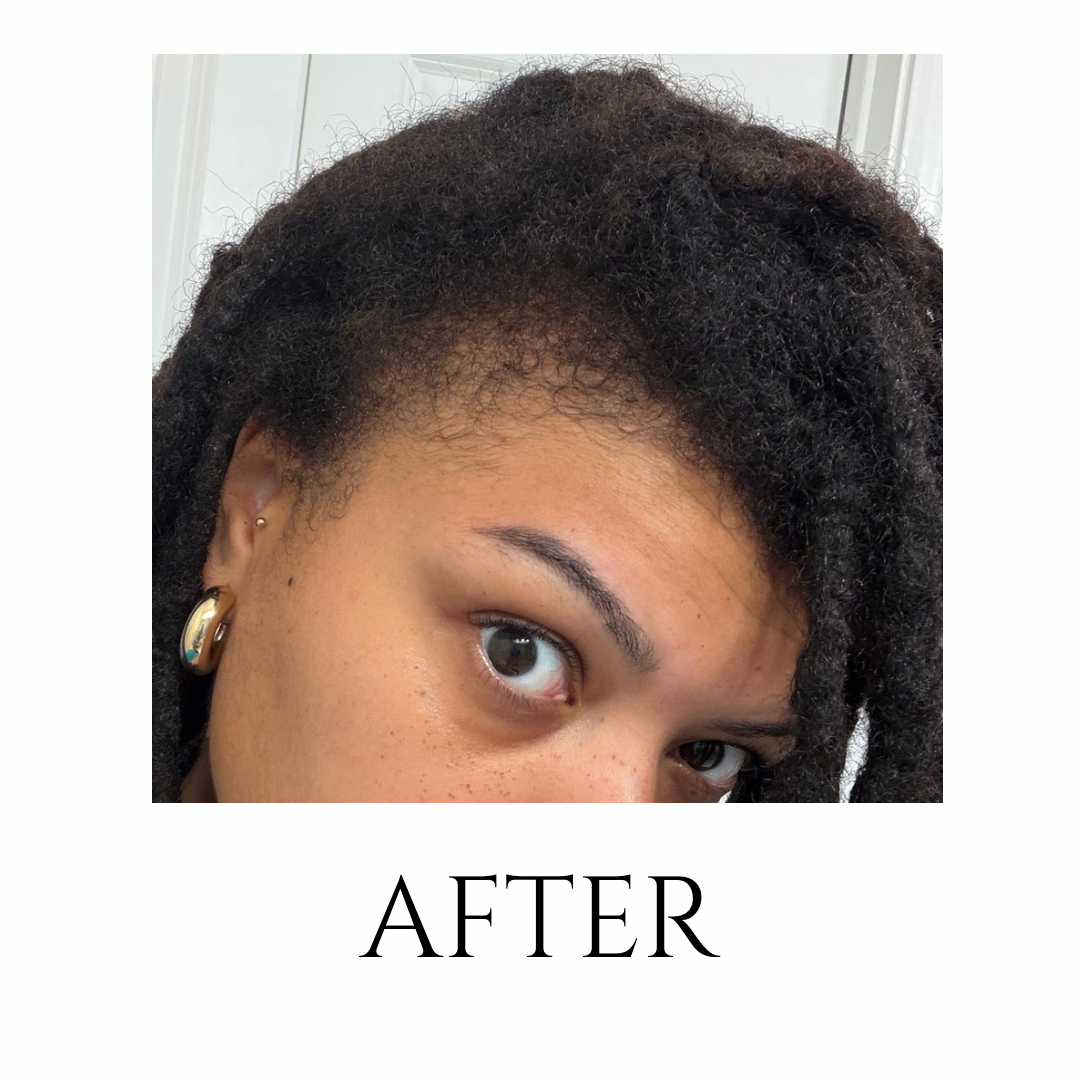 Herbal Hair & Scalp Oil